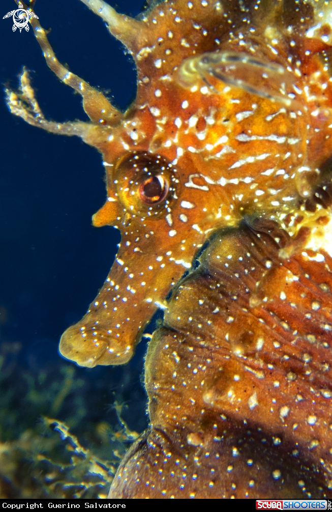 A Hippocampus